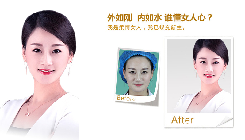 衢州V脸、线雕隆鼻